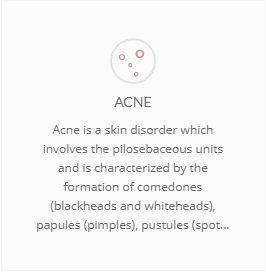 Acne banner