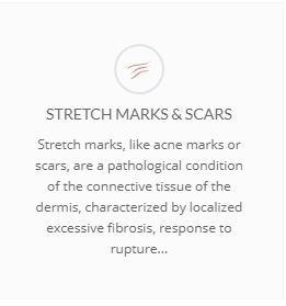 Stretch marks & scars banner